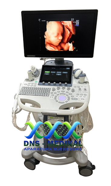 Voluson S8T